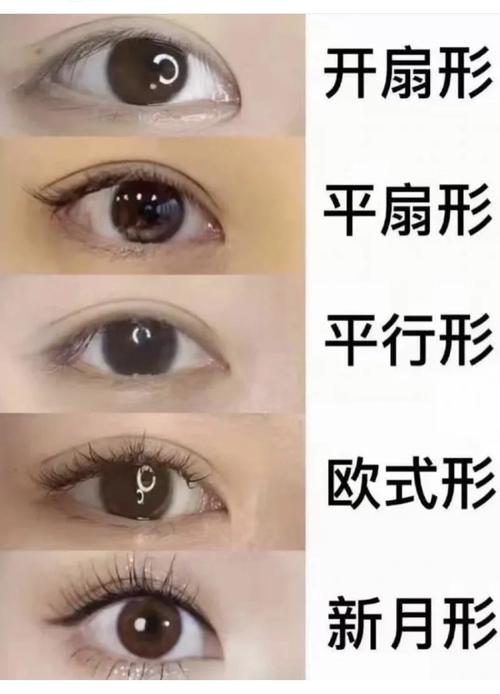 双眼皮有几种类型